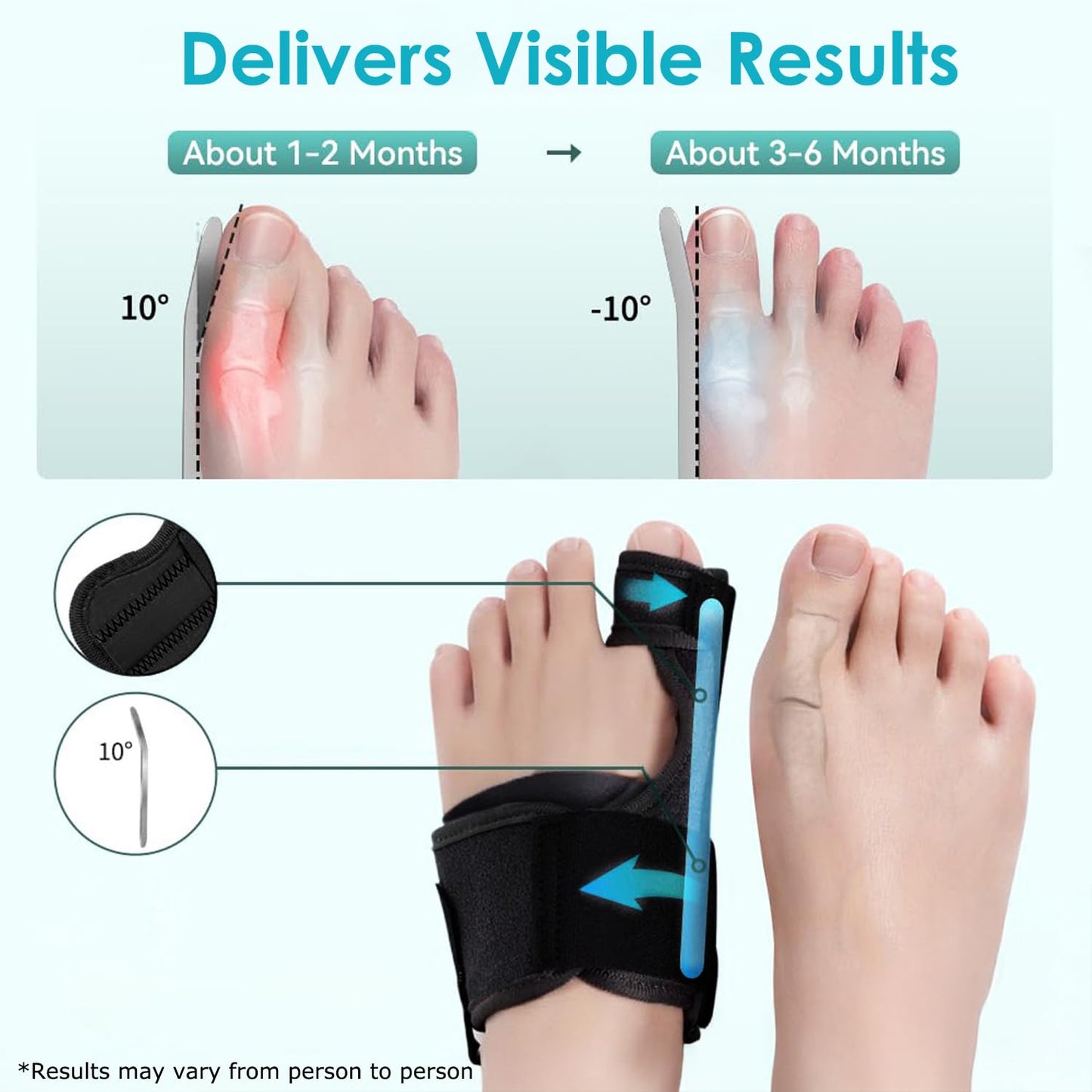 VISOOP Toe Straighteners Bunion Corrector Alignment Bar Support Device in DEMO