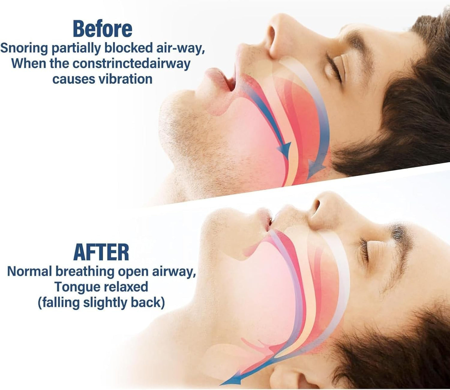 GoTags Anti Snoring Mouthpiece Soft Snore Stopper for Men and Women