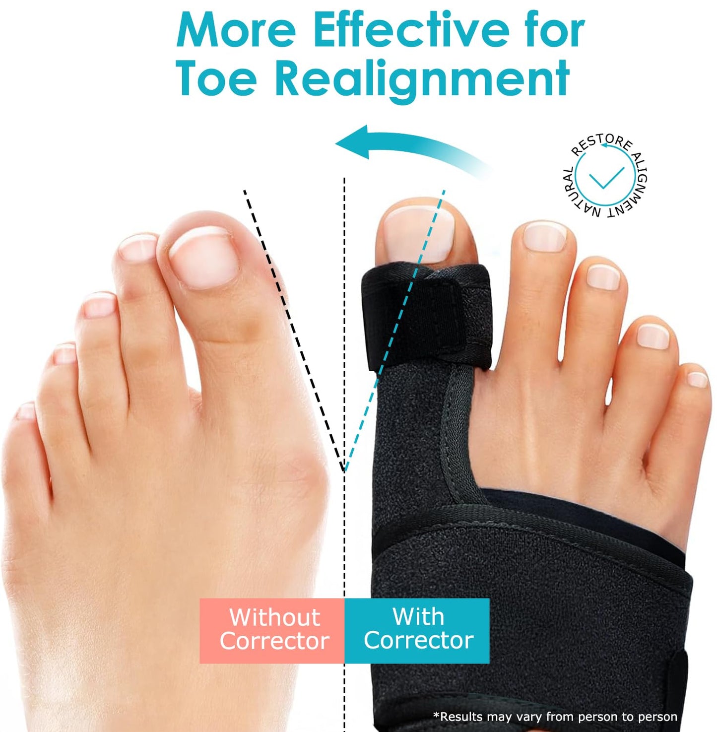 VISOOP Toe Straighteners Bunion Corrector Alignment Bar Support Device in DEMO
