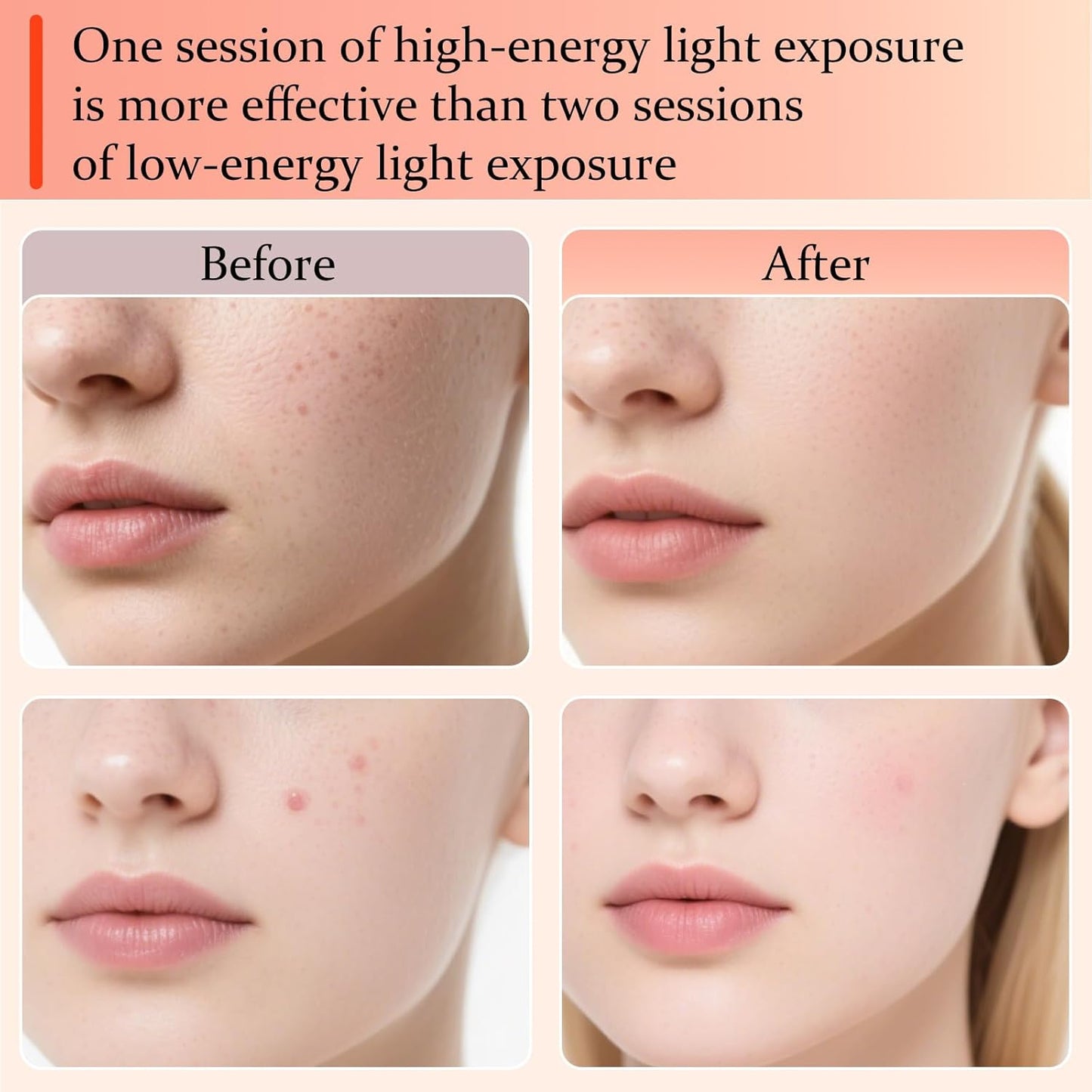 7 Color Light Therapy LED Face Mask Skin Rejuvenation Device White One Size NEW