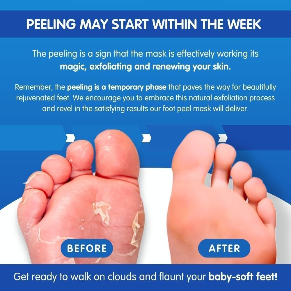 Imperial Feet Pedicure Foot Masks - Smooth, Soften & Peel Dry, Cracked Skin NEW