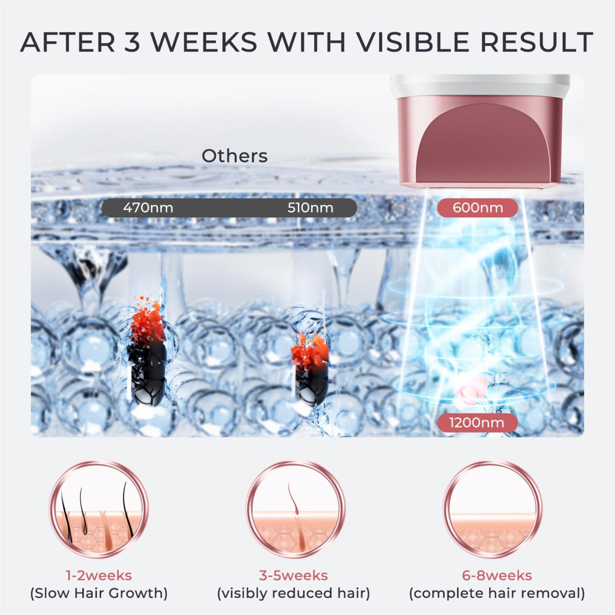 Intense Pulsed Light (IPL) Laser Hair Removal Device in White & Pink NEW