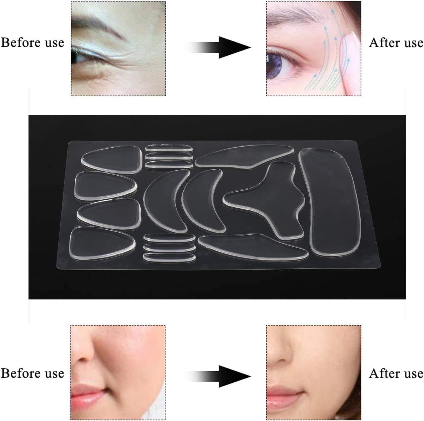 TOYSS Transparent Masks Facial Forehead Anti Wrinkle Patches, 16 Pcs, Skin NEW